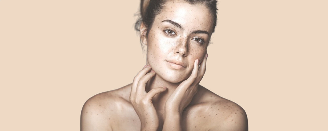 Laser Pigmentation Removal Cost In Delhi