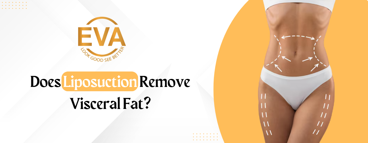 Does Liposuction Remove Visceral Fat?