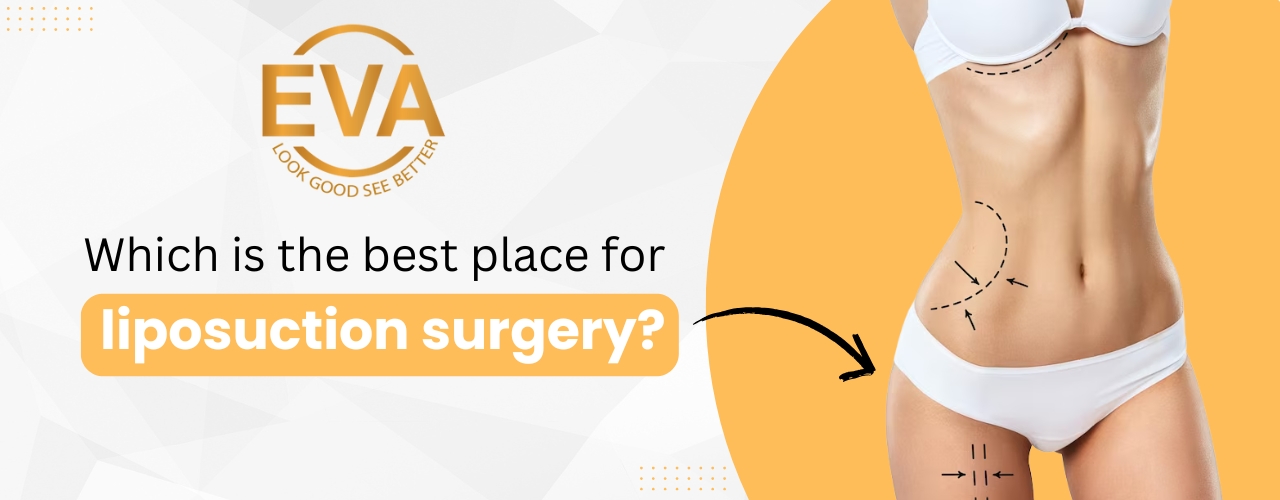 Which is the best place for liposuction surgery?