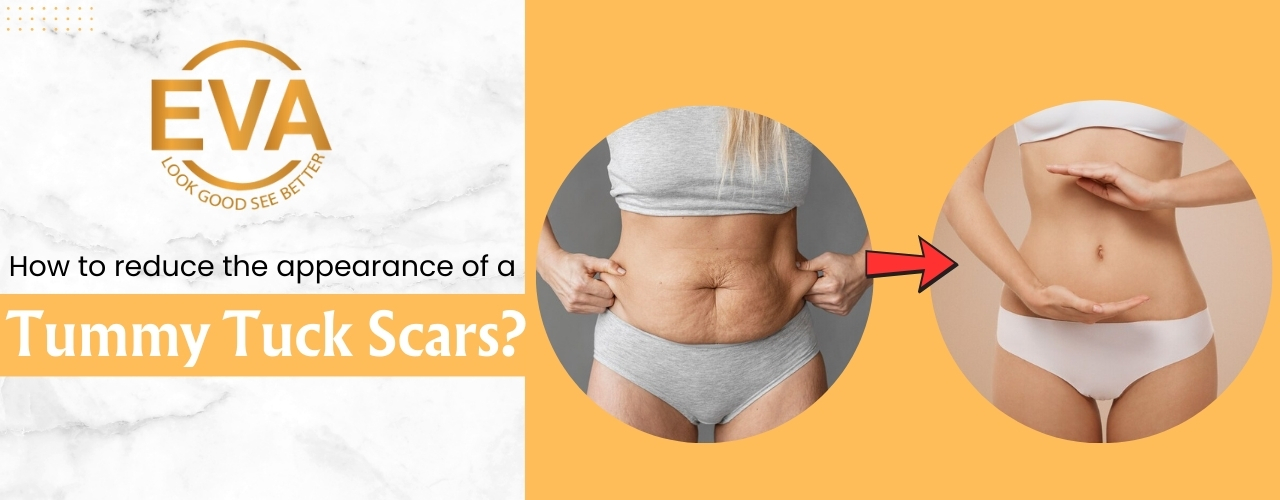 How to reduce the appearance of a tummy tuck scar?