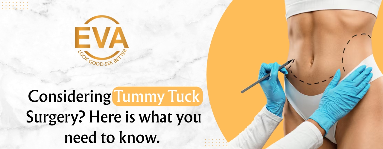 Considering Tummy Tuck Surgery? Here is what you need to know.