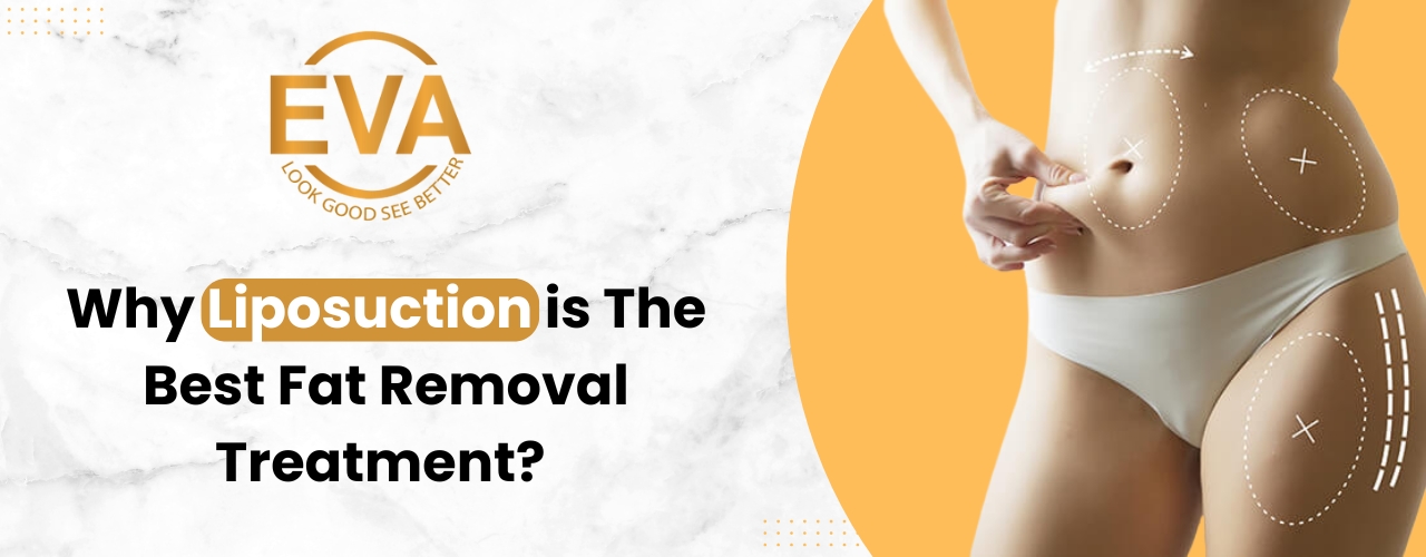 Why liposuction is the best fat removal Treatment?