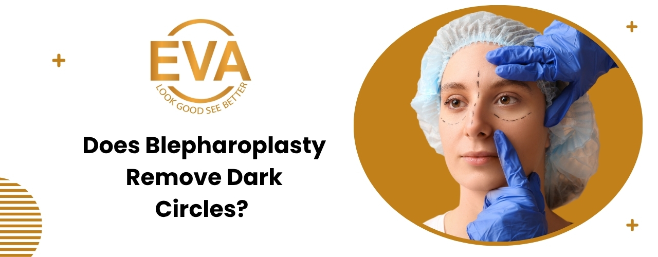 Does Blepharoplasty Remove Dark Circles?