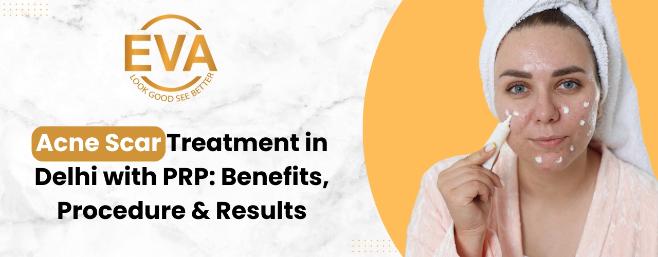 Acne Scar Treatment in Delhi with PRP: Benefits, Procedure & Results