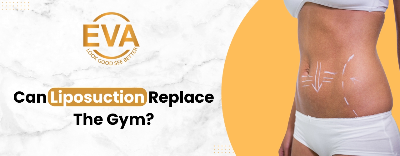 Can Liposuction Replace the Gym?