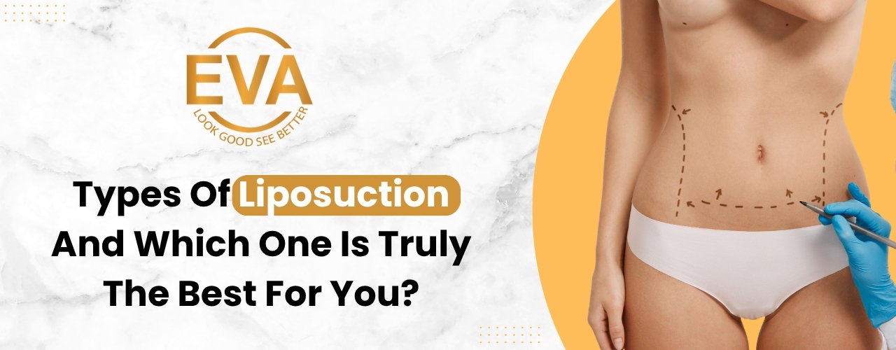 Types of Liposuction – And Which One Is Truly the Best for You?