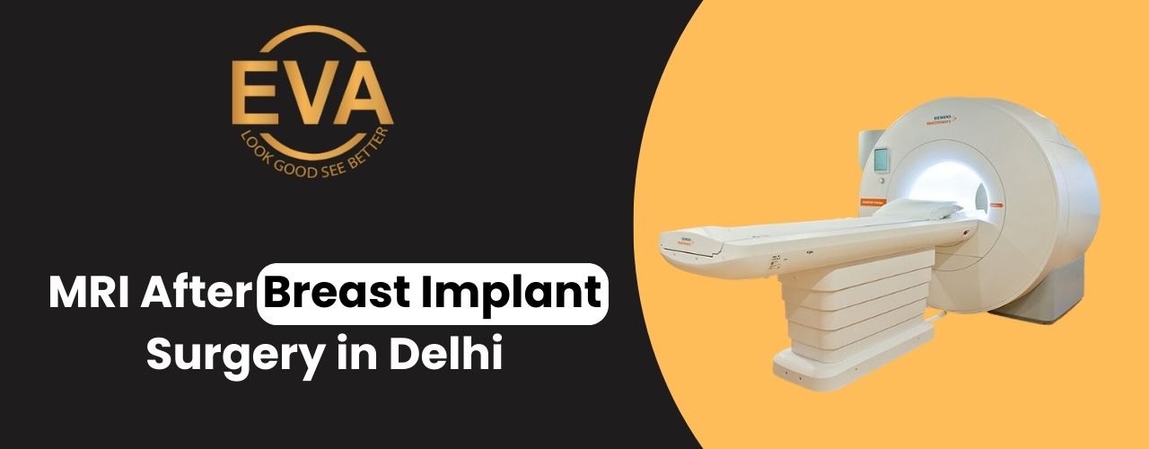 MRI After Breast Implant Surgery in Delhi