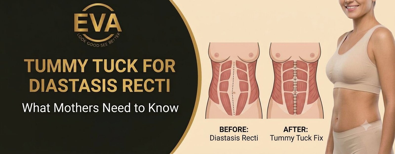 Can a Tummy Tuck Fix Diastasis Recti After Pregnancy? What Mothers Should Know