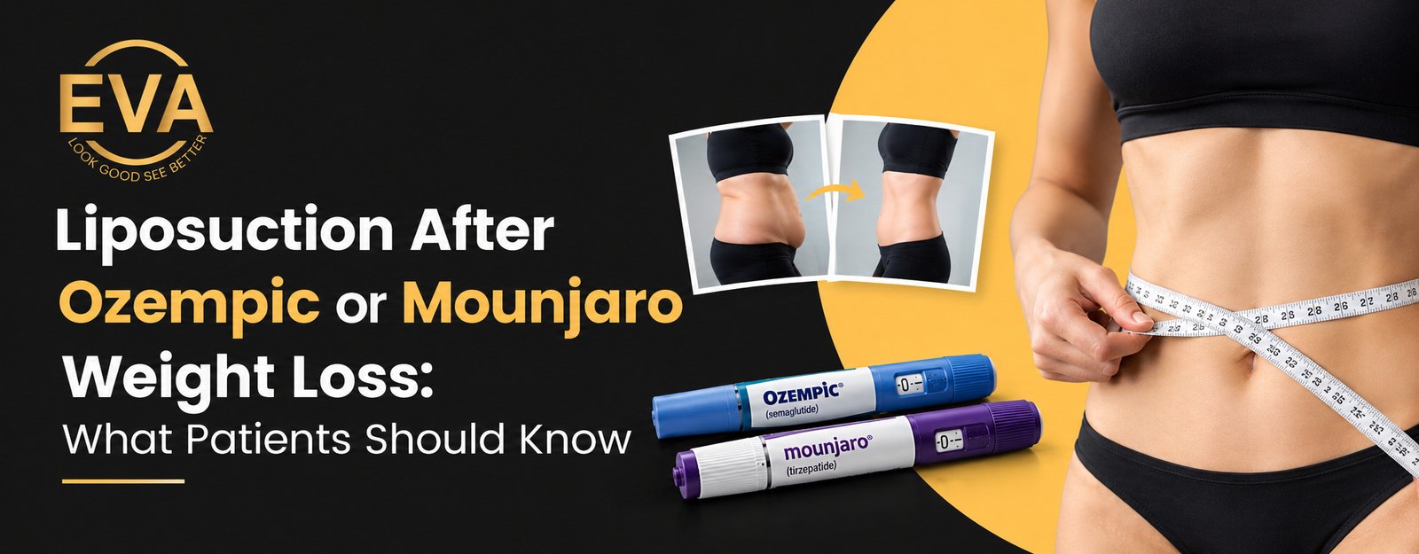Liposuction After Ozempic or Mounjaro Weight Loss in Delhi